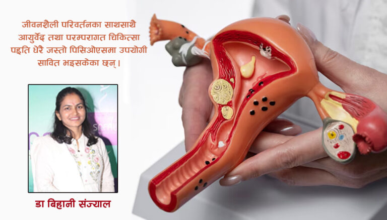 पिसिओएसमा एकीकृत चिकित्सा प्रणाली लाभदायक