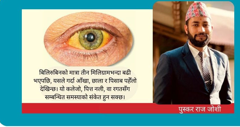 जन्डिस भनेको के हो ? जन्डिस हुँदा के खाने, के नखाने?